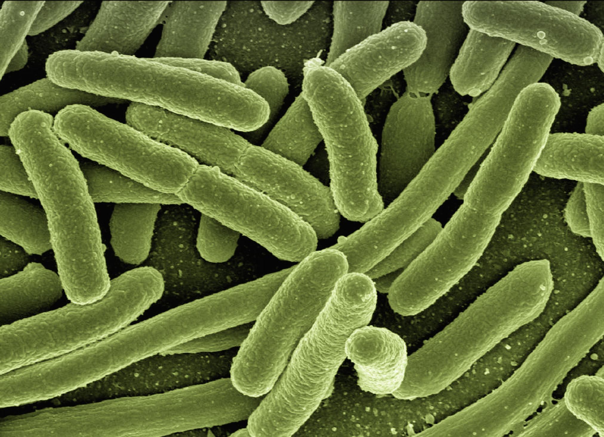 koli-bacteria-123081.jpg